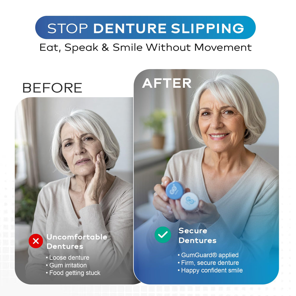 Denture Reline Kit (Pack of 4) E836